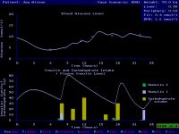 AIDA freeware diabetes software simulator program of blood glucose-insulin action
