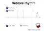 Restore rhythm 1