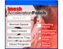 Imesh Acceleration Patch 4.9.4
