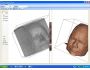 Medical Volume Viewer 1