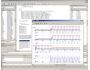 MatBasic 1.2
